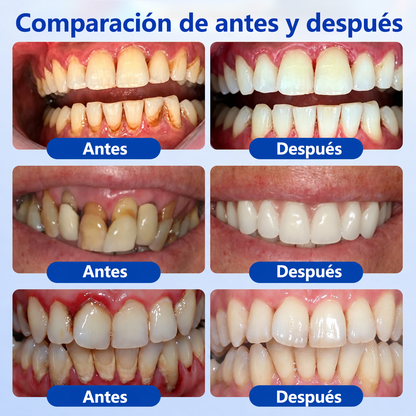 ☎️🛡️𝑮𝒍𝒊𝒎𝒎𝒆𝒓𝒍𝒚® 𝑮𝒖𝒎𝑹𝒆𝒗𝒊𝒗𝒆 𝑮𝒆𝒍 𝑹𝒆𝒑𝒂𝒓𝒂𝒅𝒐𝒓 𝑷𝒆𝒓𝒊𝒐𝒅𝒐𝒏𝒕𝒂𝒍