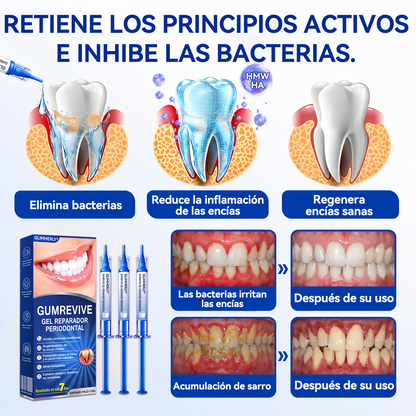 ☎️🛡️𝑮𝒍𝒊𝒎𝒎𝒆𝒓𝒍𝒚® 𝑮𝒖𝒎𝑹𝒆𝒗𝒊𝒗𝒆 𝑮𝒆𝒍 𝑹𝒆𝒑𝒂𝒓𝒂𝒅𝒐𝒓 𝑷𝒆𝒓𝒊𝒐𝒅𝒐𝒏𝒕𝒂𝒍