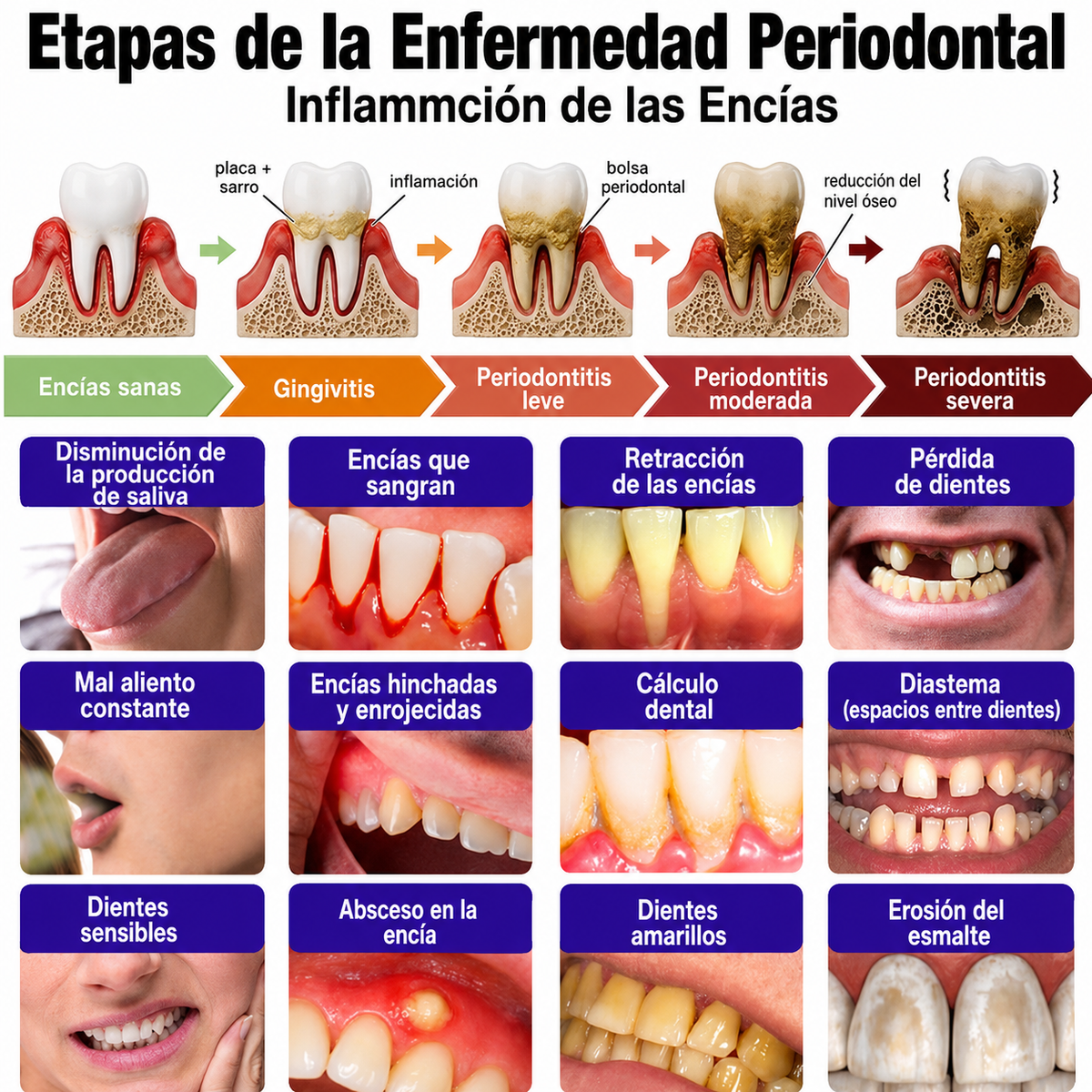 墨西哥 GLIMMERLY® VioCore: pasta dentífrica para el tratamiento de la gingivitis y la periodontitis con veneno de abeja