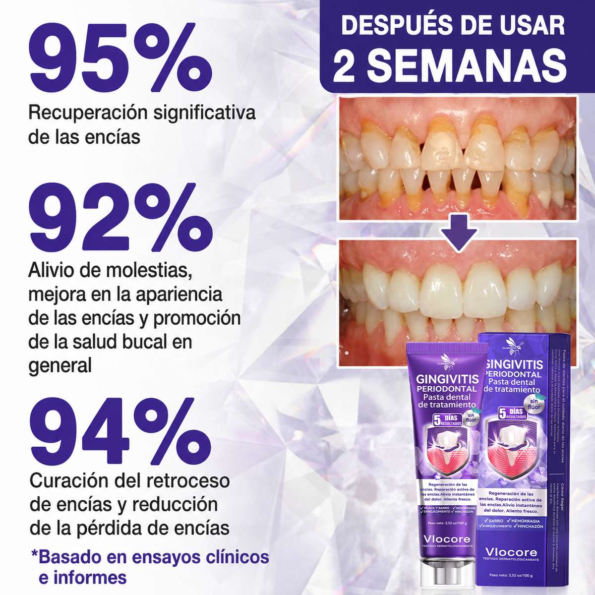 墨西哥 GLIMMERLY® VioCore: pasta dentífrica para el tratamiento de la gingivitis y la periodontitis con veneno de abeja