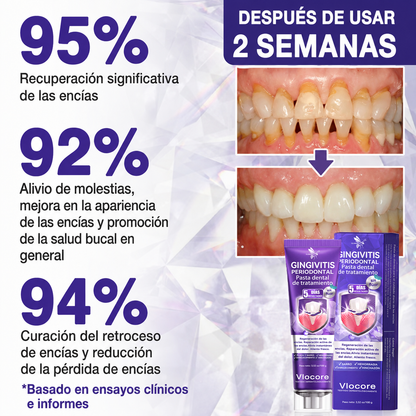 墨西哥 GLIMMERLY® VioCore: pasta dentífrica para el tratamiento de la gingivitis y la periodontitis con veneno de abeja